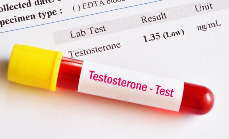 testosterones
